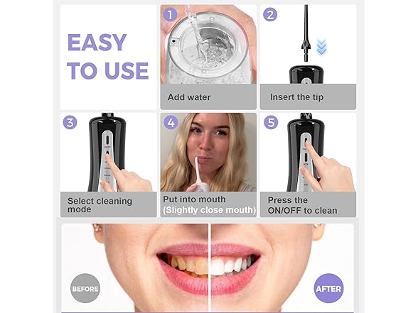 5 Mode Water Flosser W/ Bag
