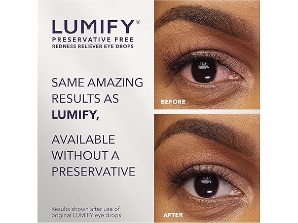 LUMIFY Eye Drops, 20 vials