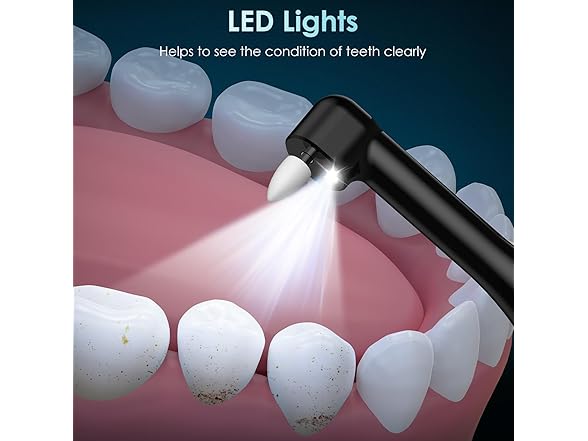 CrazyNov Tooth Polisher