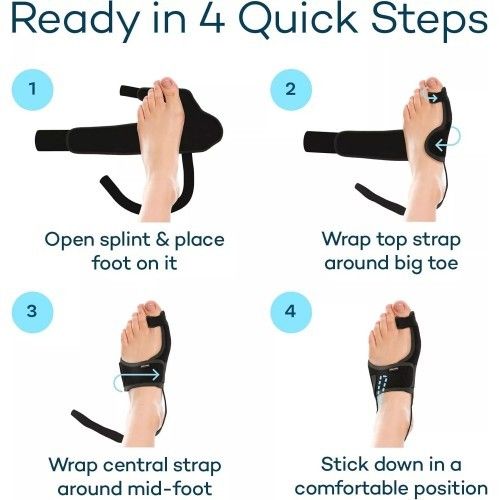 Orthopedic Bunion Toe Corrector - Gallery 7