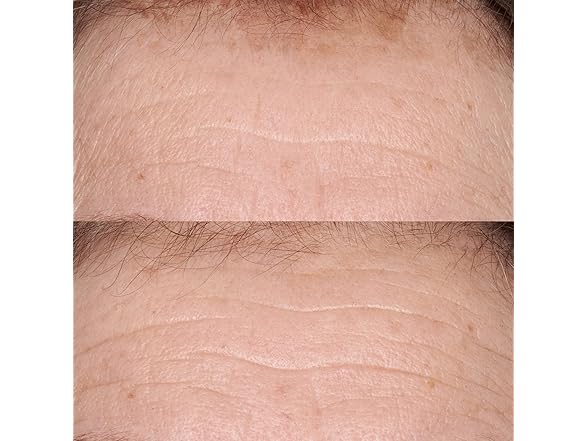 Perricone MD Hypoallergenic Clean Correc