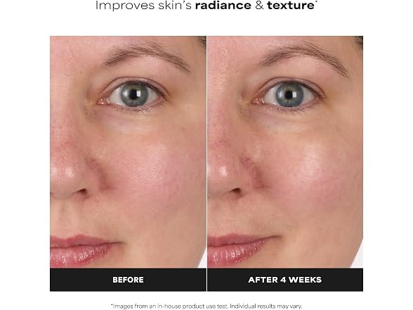 Paula s Choice Skin Balancing Pore Reduc