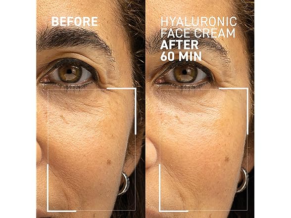 Dr. Brandt Hyaluronic Facial Cream, 1.7 oz