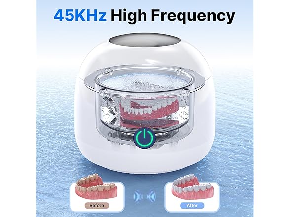 CXRUY Ultrasonic Retainer Cleaner