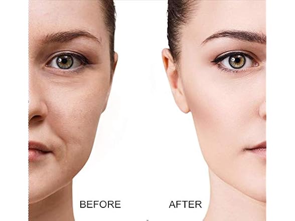 Aeyistry 4Pcs Cupping Facial Set 