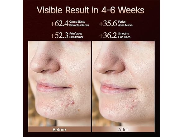 Hello Face 4D LED Light Therapy