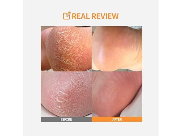 SUNGBOON EDITOR LHA Baby Foot Scrub 