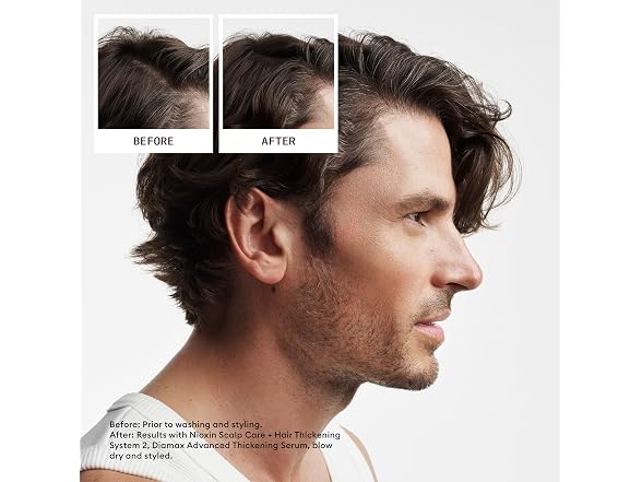 Nioxin System 2 Scalp Relief Kit Clean Shamp 072A