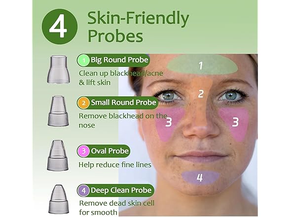 Xamoca Blackhead Remover Vacuum