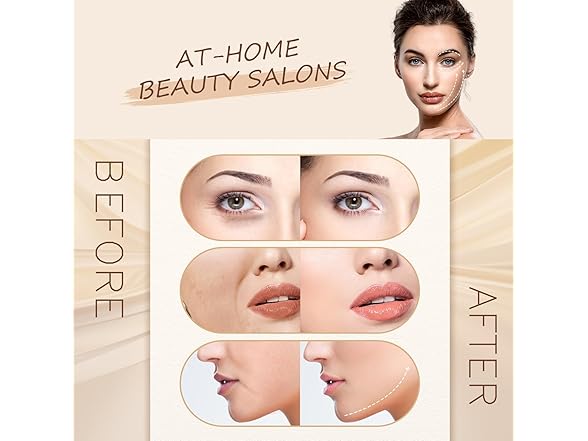 Texet 5-in-1 Skin Tightening Device