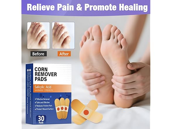 QIYANA Corn Remover Pads 30 Count