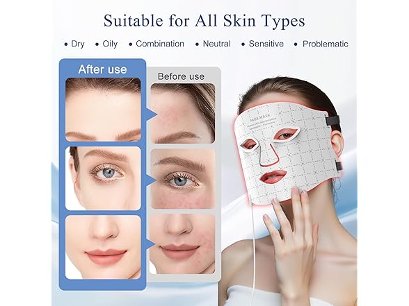 Fiogeo Red Light Therapy Face Red Light Mask