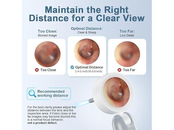 ASPOVEN 1080P HD Otoscope Ear Camera