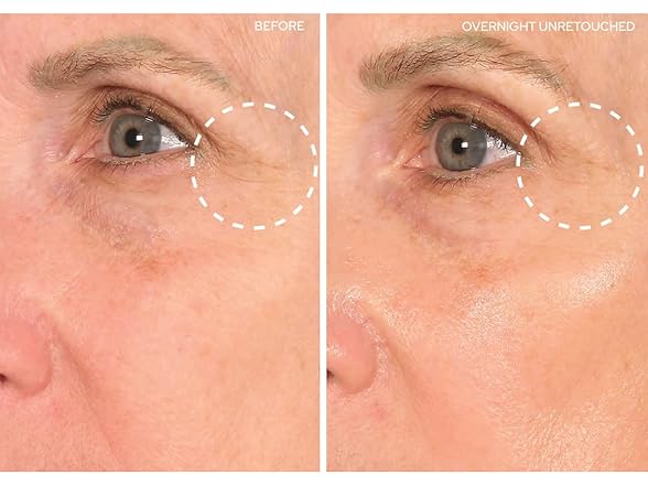 SiO Beauty Eye and Smile SuperLift