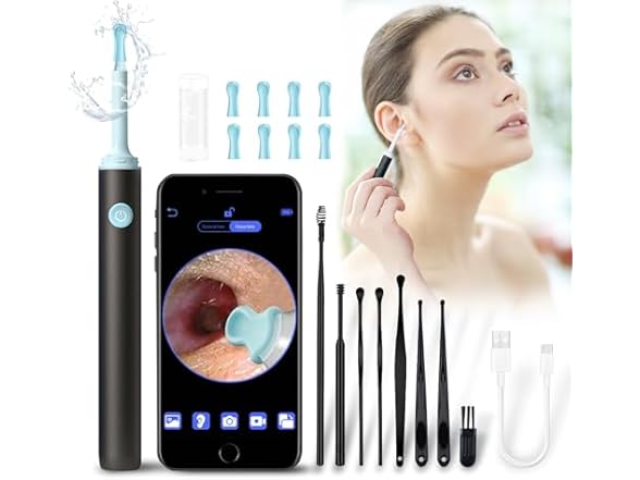 Wikups Ear Wax Removal