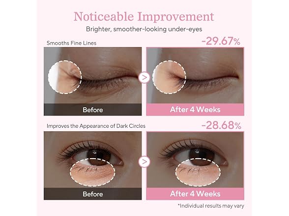 ALVESTRA PDRN Eye Cream for Dark Circles