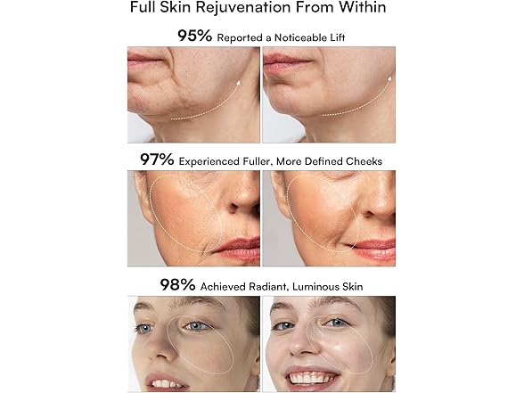 3-in-1 Red Light Skin Tightening Device- White