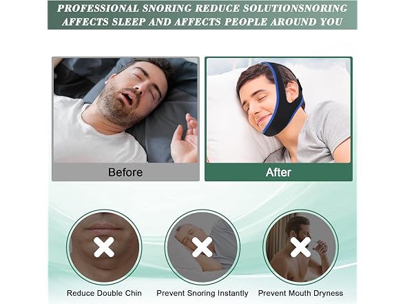 OHALEEP Anti Snoring Chin Strap for Sleep