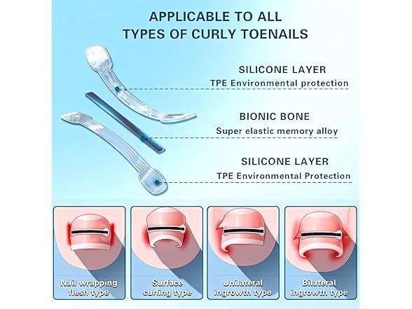 Ingrown Toenail Treatment