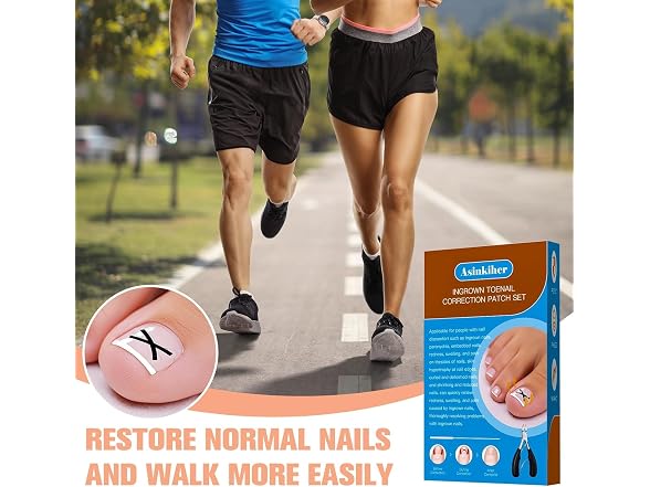 Ingrown Toenail Treatment Kit
