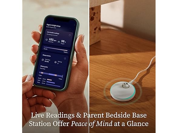 Owlet Dream Sock – Smart Wearable Baby Monitor- Choose Color