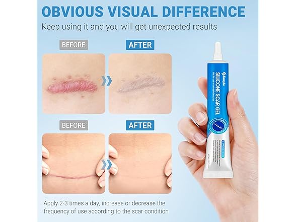 Kunyle BC521525090026 silicone scar gel