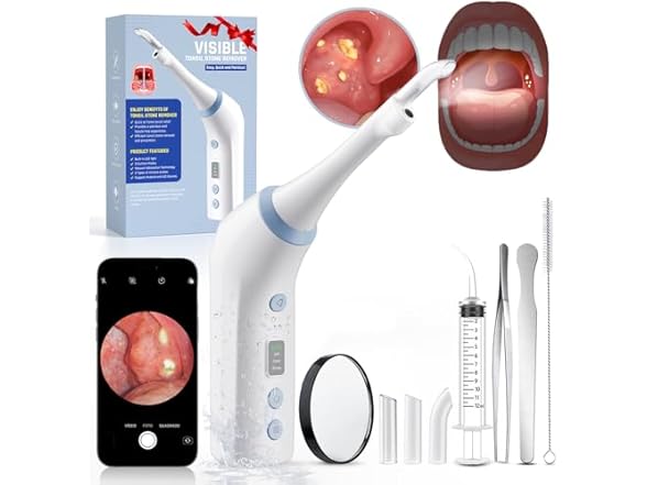 SIQIONG Electric Tonsil Stone Remover