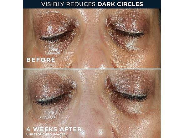 RoC Multi Correxion 5 in 1 Anti-Aging Eye Cream