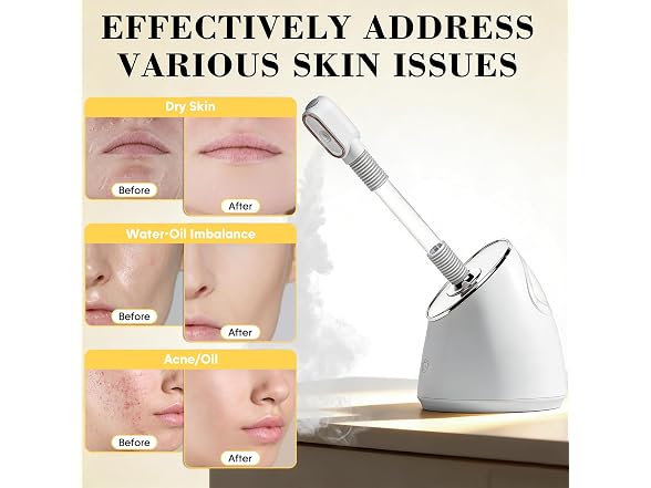 Facial Steamer Spa Kit, Nano Ionic Face