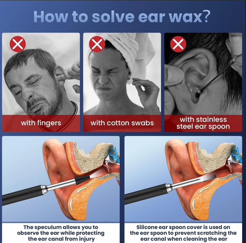 Ear Wax Removal 1080P Camera Tool - Gallery 9