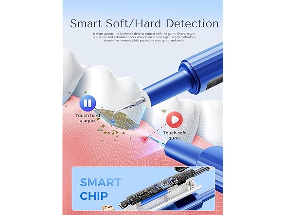 OXRMAK Plaque Remover for Teeth - Gallery 3