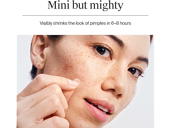 Neutrogena Mini Acne Patches 36 ct