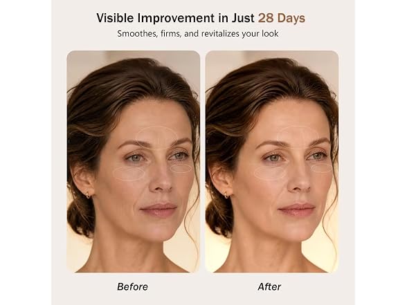 Aimilove Red Light Therapy Mask