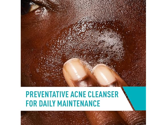 CeraVe | Acne Control Cleanser 16 oz