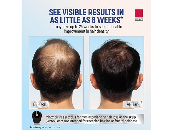 Taro Minoxidil for Men, 2.11 Oz