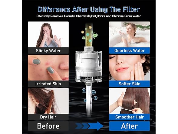 KEYCOZY NSF Shower Filter, Hard Water