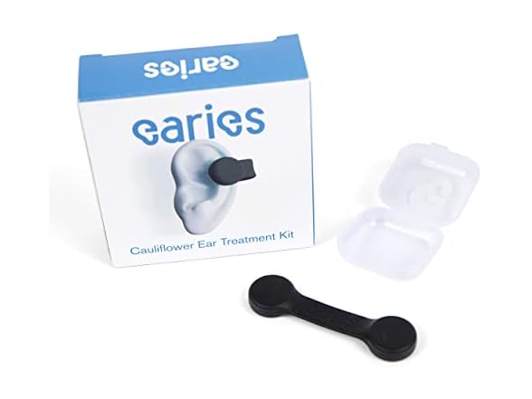 Earies Cauliflower Ear Treatment