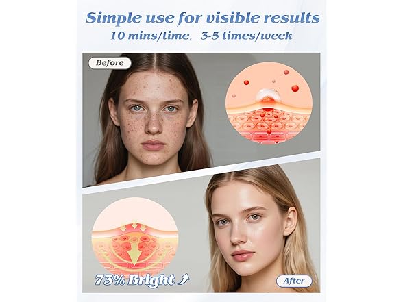 Red Light Therapy Mask