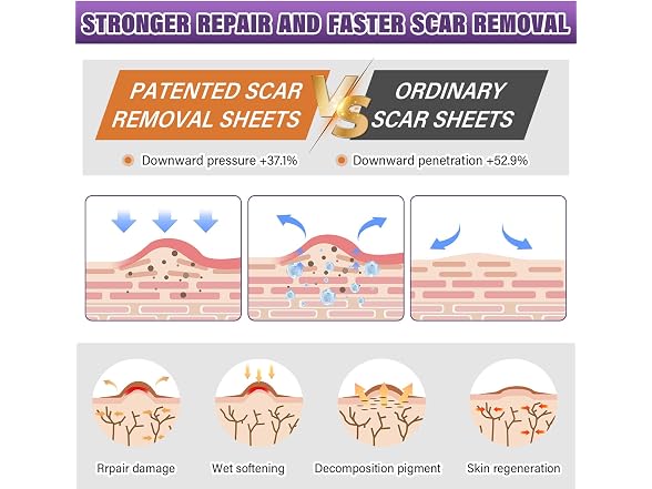 Silicone Scar Sheets