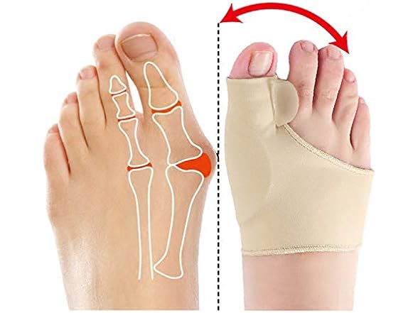 AnHua Valgus Bunion Corrector Orthotics Feet Bone