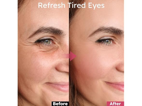 Ossjds Retinol Caffeine Eye Patches