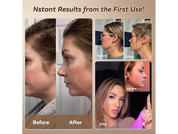 JUSRON BC135325100059 Face Strap