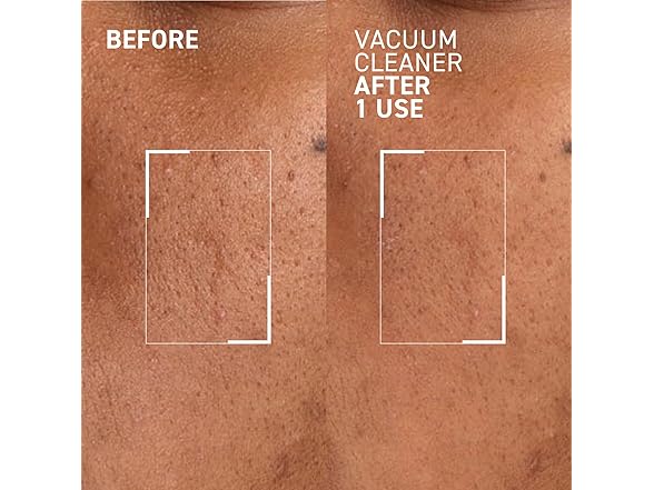 Dr. Brandt Pores No More  Mask, 1 oz
