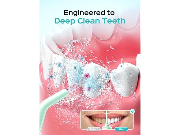 COSLUS E40 Portable Water Flosser