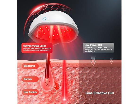 OVEKPA Laser Cap for Hair Regrowth