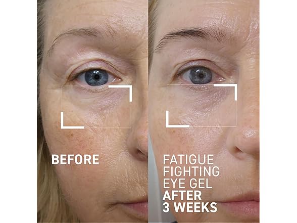 Dr. Brandt Fatigue Fighting Eye Gel, 0.5 oz