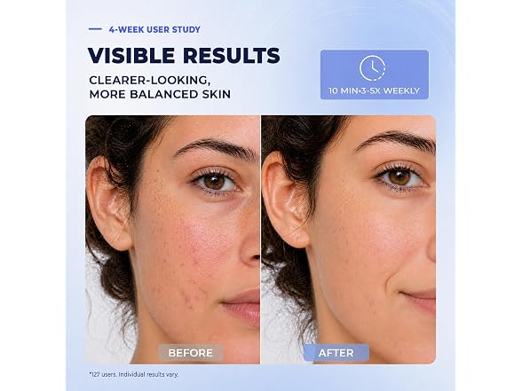 Red Light Therapy Mask - Blue