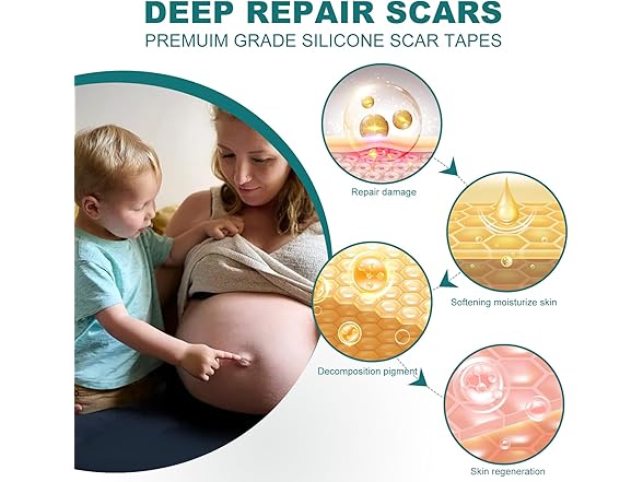 SLUKHIG Silicone Scar Tape For Scar Treatment