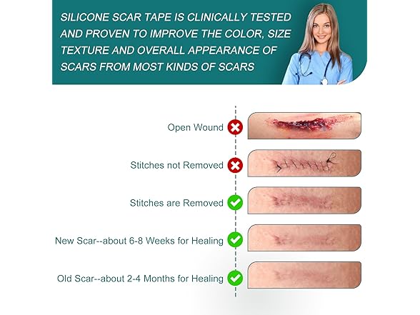 SLUKHIG Silicone Scar Tape For Scar Treatment