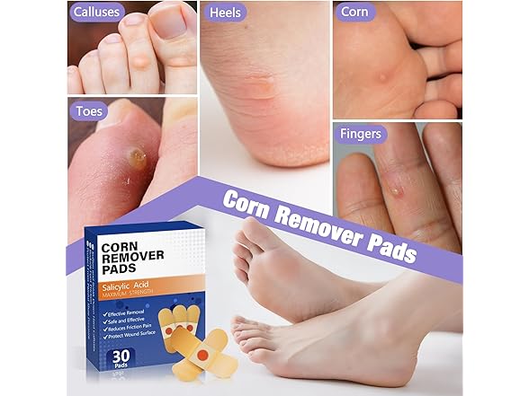 QIYANA Corn Remover Pads 30 Count